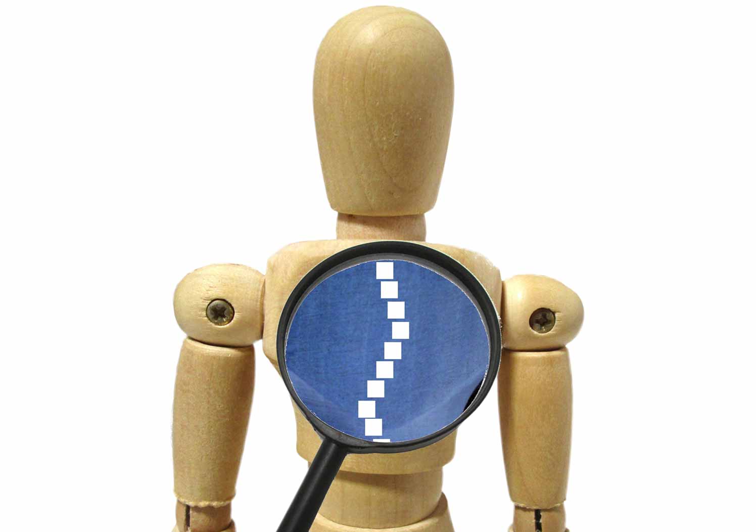 側わん症のイメージ